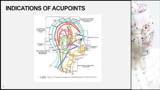 Introduction to Acupuncture part 3 [upl. by Cad]