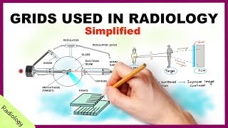 Grids Used in Radiology Simplified  Radiology [upl. by Cohl743]