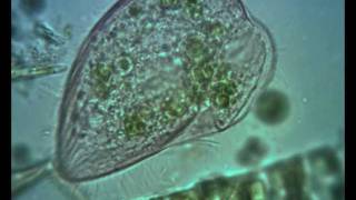 Blepharisma ciliate Contractile Vacuole in Action [upl. by Nairadas]