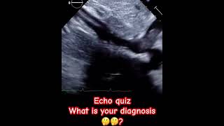 echocardiography cardiology heartmonitoring echo ytshorts SafaMedicalLecture [upl. by Ralf148]