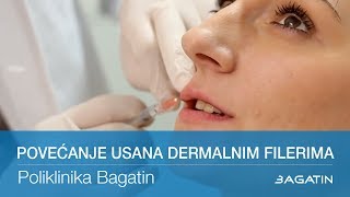 Povećanje usana dermalnim filerima [upl. by Yoral]