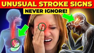 7 Uncommon Signs of Strokes You Should Know About [upl. by Anurag190]