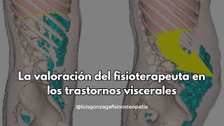 Fisioterapia y el sistema visceral [upl. by Marnia945]