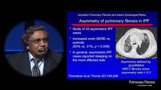 Gastroesophageal Reflux Disease GERD in ILD  Ganesh Raghu MD [upl. by Alusru]