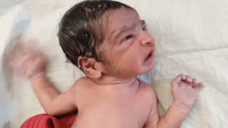 lanugo hairy newborn baby viralvideo newbornbaby babycare nicu lanugohair [upl. by Ateiram]