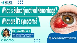 Subconjunctival Hemorrhage Blood in Eye  Symptoms Signs amp Causes of Subconjunctival Hemorrhage [upl. by Koch]