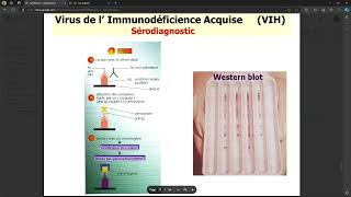 Virologie  VIH FMPC [upl. by Suzanne]