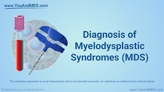 Diagnosis of Myelodysplastic Syndromes MDS [upl. by Niabi]