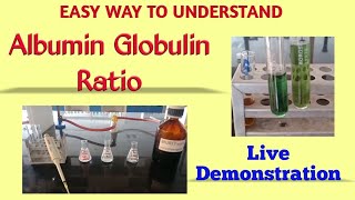 Albumin globulin ratio  Total protein estimation  Biuret method  Albumin estimation  BCG method [upl. by Desiri251]