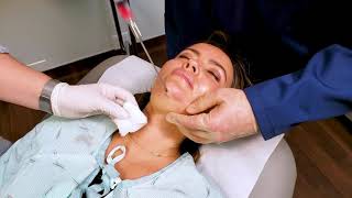 In Office Chin Liposuction [upl. by Nolyarb]