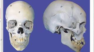 13 trauma maxilofacial en cirugía plástica [upl. by Stalker]