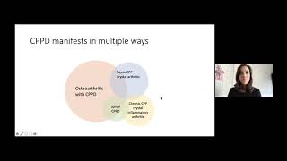 Calcium pyrophosphate deposition CPPD Working Group Overview [upl. by Battiste806]