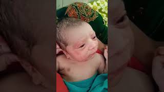 Newborn Baby After Birth ☺👍 youtubeshorts nursing medical newbornbaby childbirth cutebaby [upl. by Llerrod]