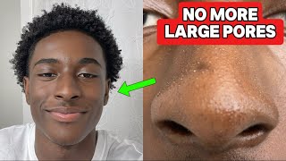 Best Ways to Get Rid Large Pores QUICKLY [upl. by Ardnwahsal807]