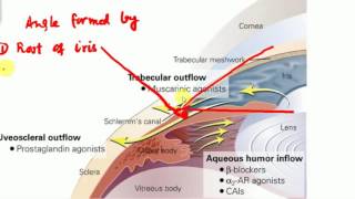 OPHTHALMOLOGY GLAUCOMA PART 2 Congenital Glaucoma BASICS [upl. by Wickner907]