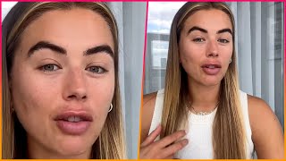 Love Islands Arabella Chi reveals she was diagnosed with PCOS after suffering a secret miscarriage [upl. by Tdnerb]