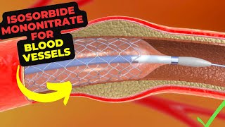 CC How to Pronounce isosorbide mononitrate Imdur Backbuilding Pharmacology [upl. by Mochun]