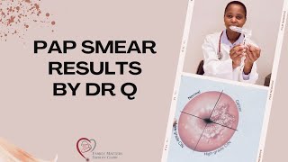 Explaining Pap Smear Results [upl. by Nossila730]