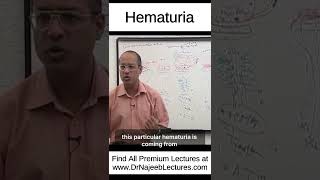 Hematuria shortvideo shorts drnajeeb drnajeeblectures [upl. by Ellenar]