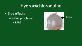 Hydroxychloroquine for Rheumatoid Arthritis [upl. by Ford]