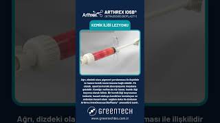 Arthrex IntraOsseous Bioplasty®️ IOBP [upl. by Yrtnej]