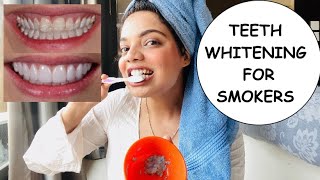 Teeth whitening for smokers at home  Super Effective  Beauty’s crown [upl. by Casia]