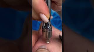 skincare skincareroutine skincaretips shorts facial trending chennai tamil tamilnadu 🥰👇🏽 [upl. by Acsecnarf]