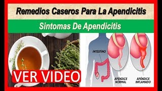 Remedios Caseros Para La Apendicitis Sintomas De Apendicitis De Que Lado Esta El ApendiceApendice [upl. by Ynamrej]