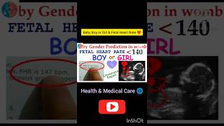 Baby Boy or Girl amp Heart Rate preganacy baby babyboy babygirl heartbeat gender ytshortsviral [upl. by Nitsoj]