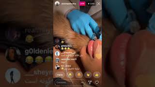 CLERMONT TWINS GET CHEEK and LIP INJECTIONS ON INSTAGRAM LIVE [upl. by Aiclid301]