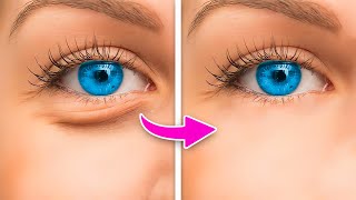 HOW TO MAKE UNDER EYE BAGS DISAPPEAR IN SECONDS [upl. by Ailene]