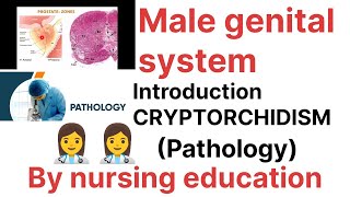 PathologyMale genital system Introductioncryptorchidism Bsc nursing [upl. by Roberts583]