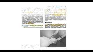 emergency care  chap 3  Airway Management PART1 [upl. by Rysler935]