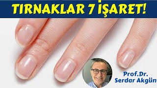 Tırnaklarınız ve sağlığınz  Tırnaklardaki Çizgiler Kırılma ProfDrSerdar Akgün [upl. by Raskin]