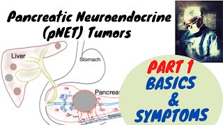 Pancreatic Neuroendocrine Tumor Part 1 Basics and Symptoms [upl. by Asemaj]