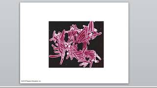 10 3 mycoplasmas and mycobacteria [upl. by Sophey476]