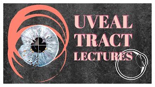 UVEAL TRACT lecture 8 TUBERCULOUS UVEITIS made easy [upl. by Leilah]