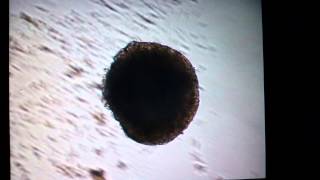 Beating 10 day old embryoid body from mES cells [upl. by Matthiew766]