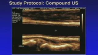 Advanced Sonography of Carotid Arteries Lecture in English [upl. by Eeleak]