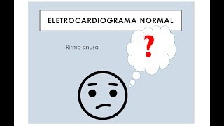 ECG Normal e Arritmias sinusais [upl. by Nnylarac]