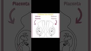 Why Your Placenta Location Matters [upl. by Joselow693]