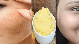 pigmentation home remedy get clear Spotless skin with this remedy kaurtips [upl. by Pancho]