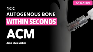 Easy way to get autogenous bone within seconds ACM Auto chip maker [upl. by Columbyne]