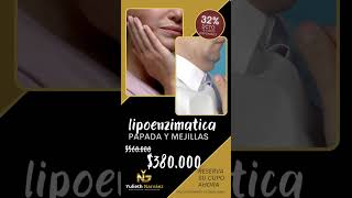 bichectomia y lipopapada enzimática [upl. by Azral]