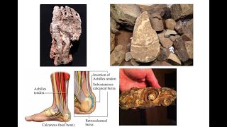 New Missed Hominid Species Have Recently Been Found called Notoes [upl. by Thorman]