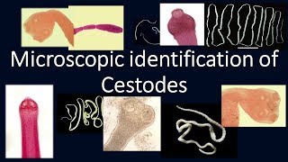 Microscopic identification of CestodesCestodesMLSHelminthsTaeniasoliumTaeniaHymenolepis [upl. by Lucania963]