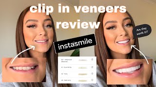 I GOT CLIP IN VENEERS INSTASMILE REVIEW Are clip in Veneers WORTH IT  Ellie Dawe [upl. by Boote]