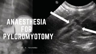 Anaesthesia for pyloromyotomy [upl. by Brine]