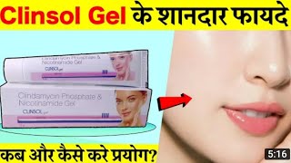 Clinsol gel review in hindi एक्ने पिम्पल ऑयली स्किन के लिए असरदार दवा Clinsol gel uses [upl. by Congdon]