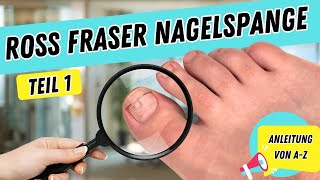 ROSS FRASER NAGELSPANGE  Teil 1  NAGELSPANGE anfertigen  NAGELSPANGE bei eingewachsenen Nägeln [upl. by Adoh]